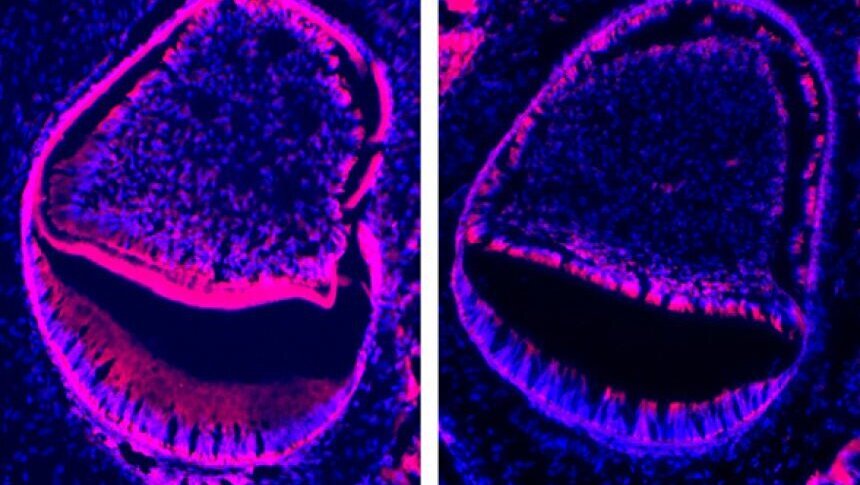 Une découverte génétique pourrait mener à des progrès dans les traitements dentaires