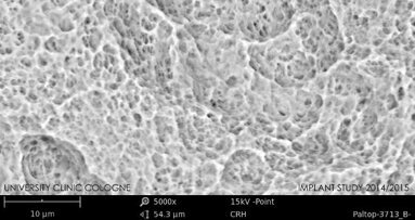 Clean dental implants essential for clinical success