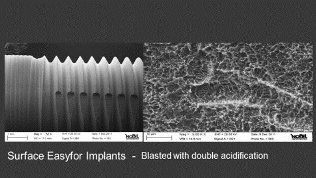 Valutazione a 12 mesi  degli impianti Easyfor cilindrici secondo i criteri di successo/insuccesso descritti in letteratura. Studio prospettico multicentrico. Analisi su 50 casi