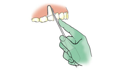 Neues Extraktionsprinzip