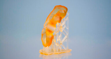 New method allows production of customised photopolymers for dentistry
