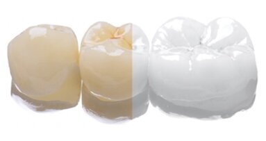 RAW vs JPEG en fotografía dental