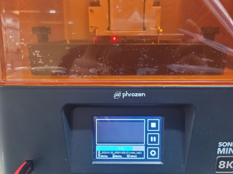 Fig. 9: Sonic Mini 8K during fabrication of the provisional crown.