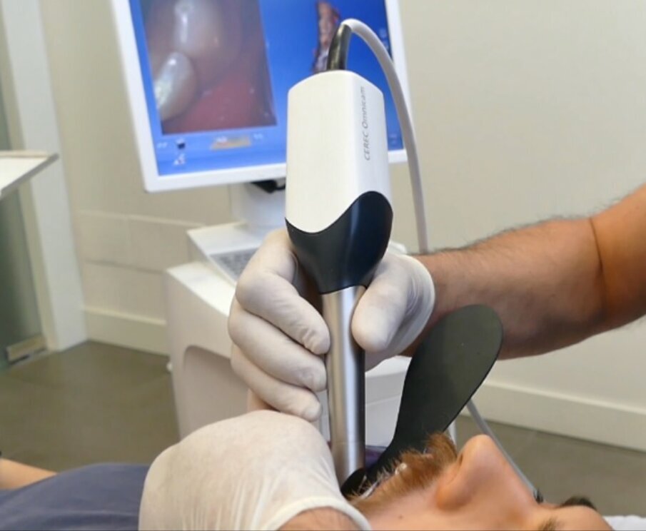 Fig. 8_La scansione intraorale post-operatoria con scanner Dentsply Sirona Omnicam.
