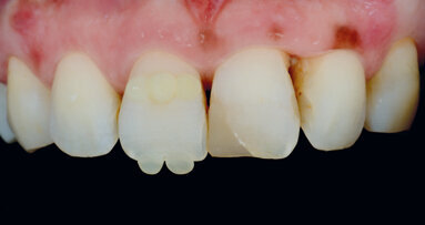 Jednoduchá souhra odstínů k vytvoření opticky harmonické výplně