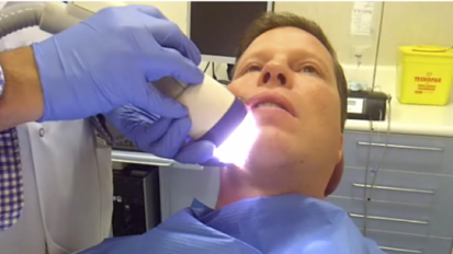 Las ondas de choque llegan a la implantología dental