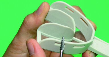 Implants + Empreintes : Compliqué ?