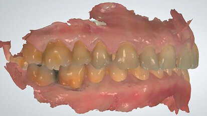 L’ortodonzia nell’era del digitale: il conflitto di meraviglie secondo Einstein