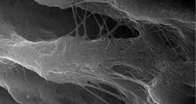 Od každodenní stomatologie k pokročilým fotoakustickým endodontickým prostředkům (PIPS): laser s dvojí vlnovou délkou Er:YAG & Nd:YAG