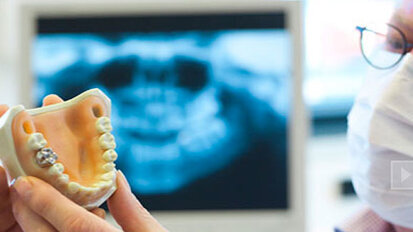 Dental association raises awareness as implant industry grows