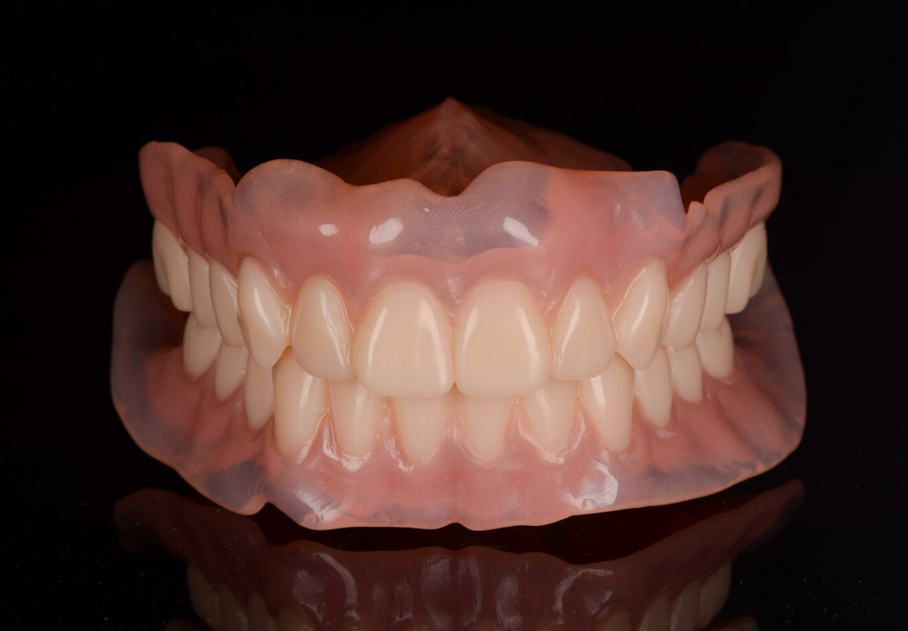 Fig. 11: Provisional 3D-printed complete dentures after final polishing.