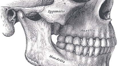 Orthognathic surgery: The definitive answer? Orthognathic surgery: The definitive answer?