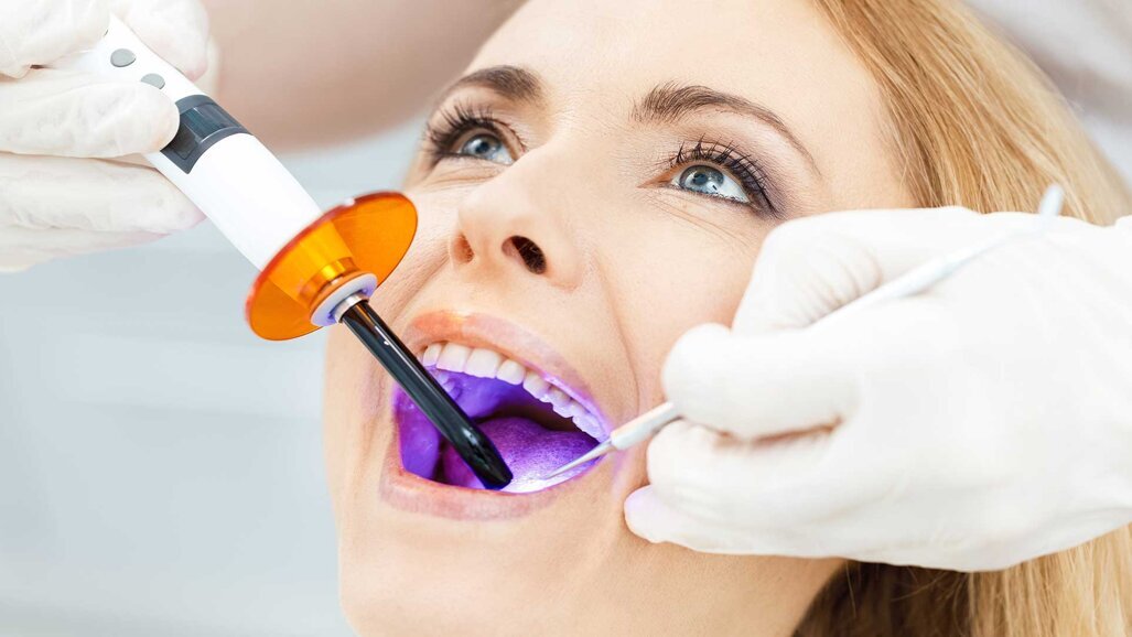 UV-Licht: Neuer Ansatz für verbesserte Implantatinsertion