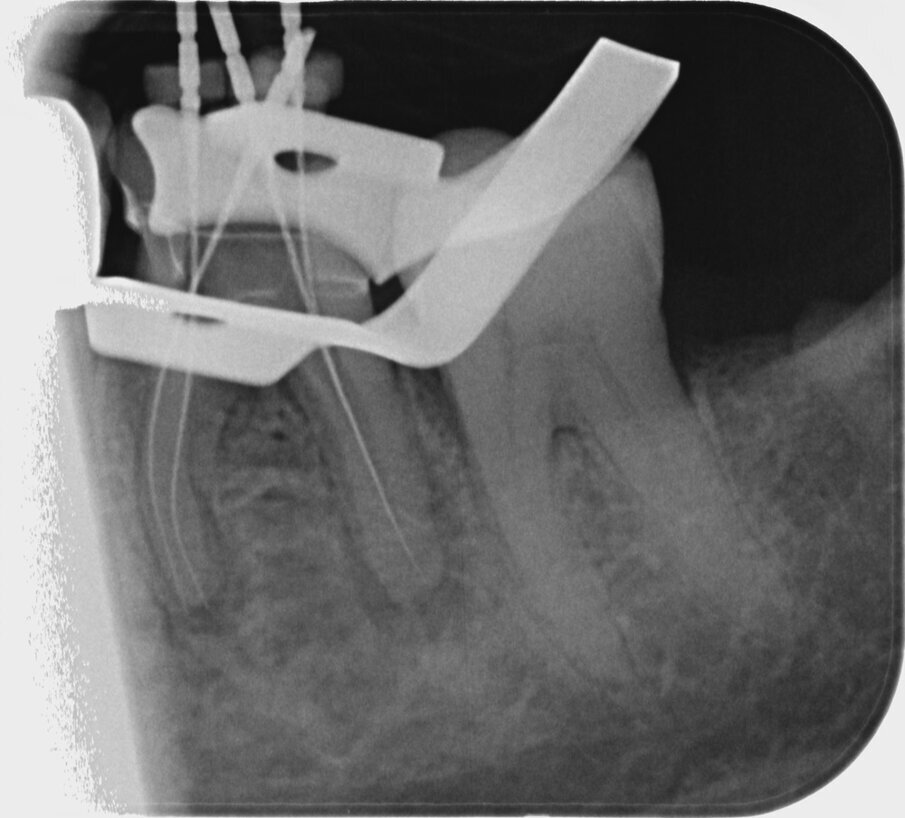 Fig. 14: Contrast image.