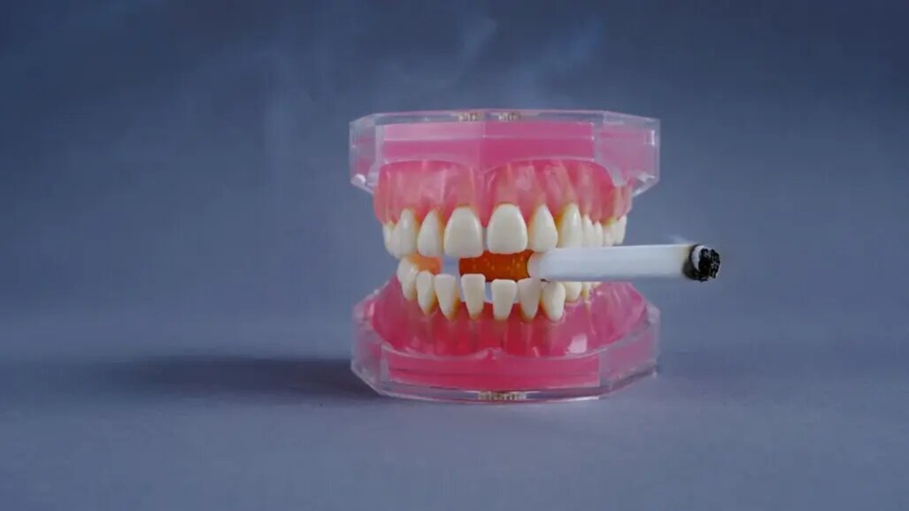 Проучване сравнява влиянието на електронните и обикновените цигари, наргилето и бездимния тютюн върху зъбните импланти