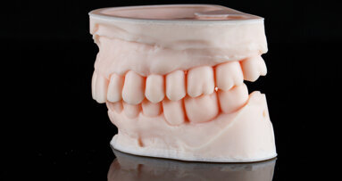 3D-printing acquisition may help Align Technology to break the mould