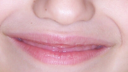 Estetica e salute del sorriso del bambino