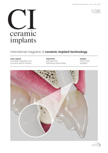 ceramic implants international No. 1, 2026