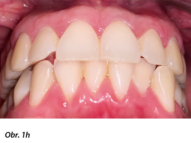 Pacientka 1 – Počáteční fotografie.