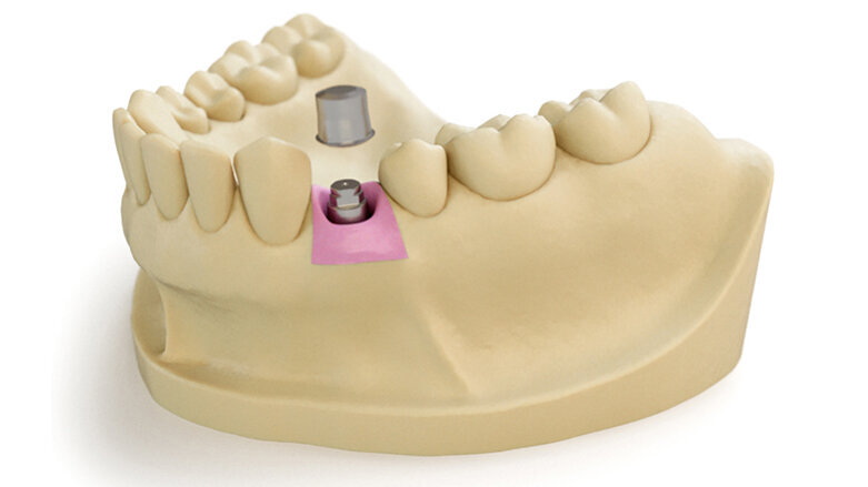 Retence získává nový význam