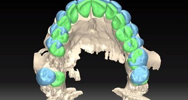 CBCT in orthodontics