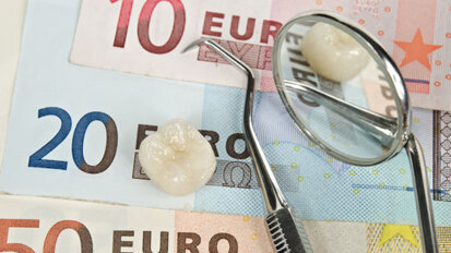 GOZ: BZÄK hat keine Analogliste