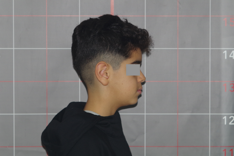 Fig. 11b: Profile view.