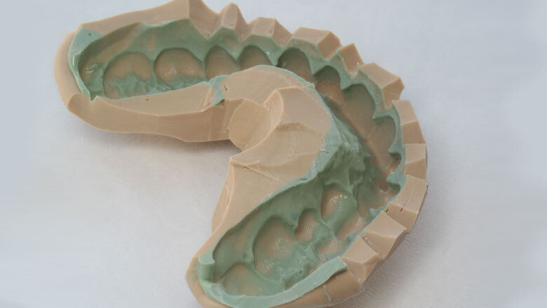 Figura 6. Impresión del modelo de trabajo estereolitográfico.