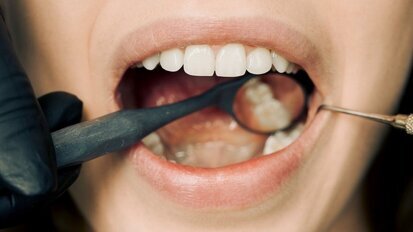 Diş Tedavisi Ücretlerine Güncelleme Geldi