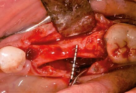 Fig. 8 - Scheletrizzazione.