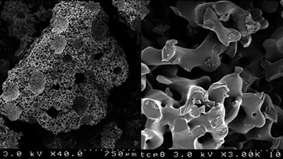 Bone augmentation of canine frontal sinuses using a porous α-tricalcium phosphate for implant treatment