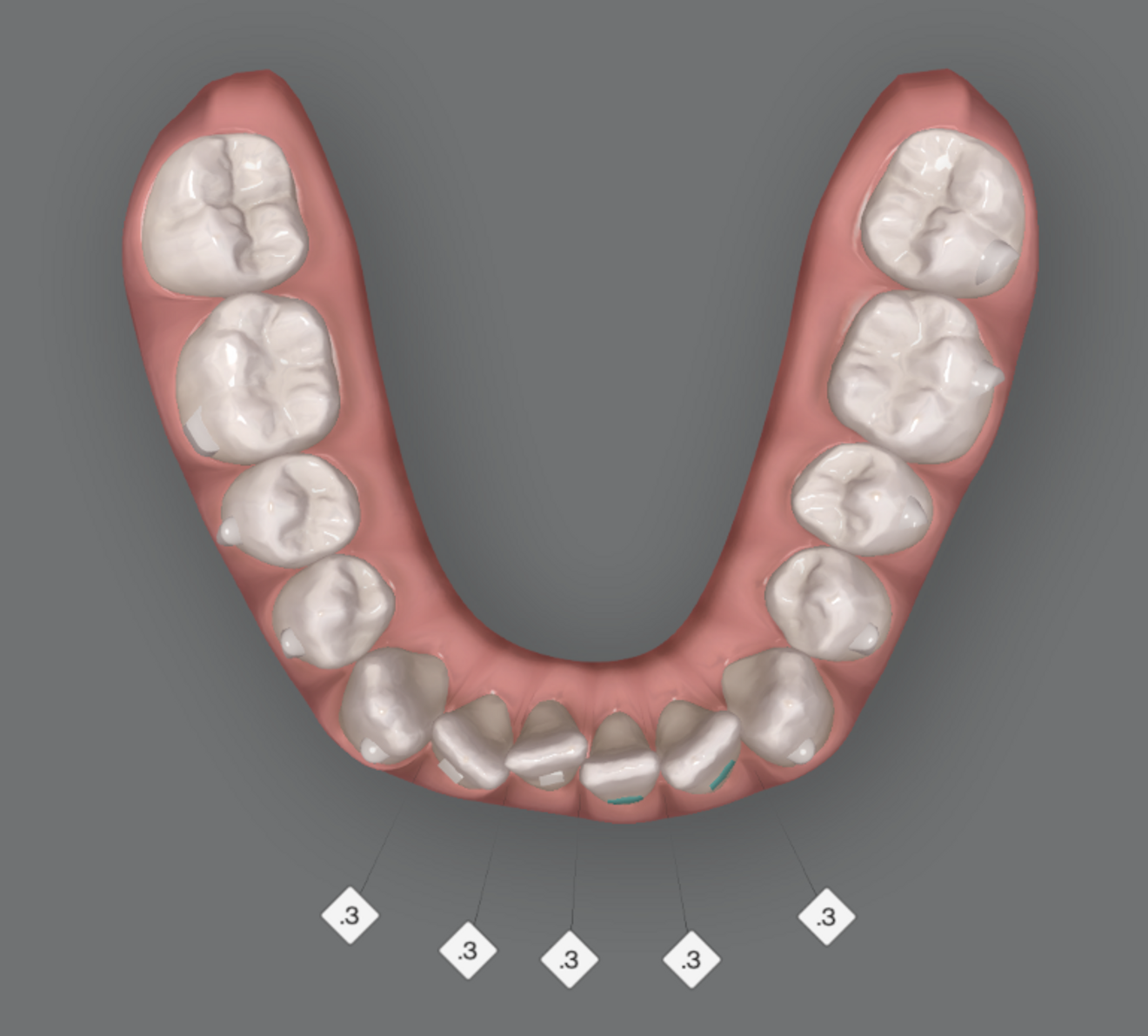 Fig. 2: Non-ideal stage for IPR.
