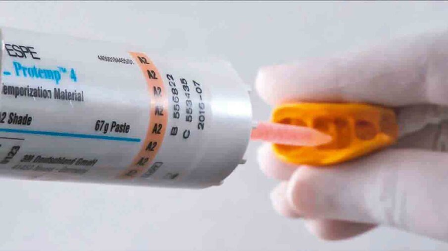 Fig. 4: Following tooth preparation, a temporary crown is produced chairside with 3M™ Protemp™ 4 Temporization Material. This material exhibits a high strength and a natural gloss without polishing.