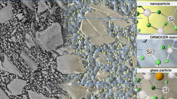 Webinar: Expert presents first purely ceramic-based restorative material