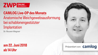 CAMLOG Live-OP am 22. Juni ab 14.00 Uhr CAMLOG Live-OP am 22. Juni ab 14.00 Uhr