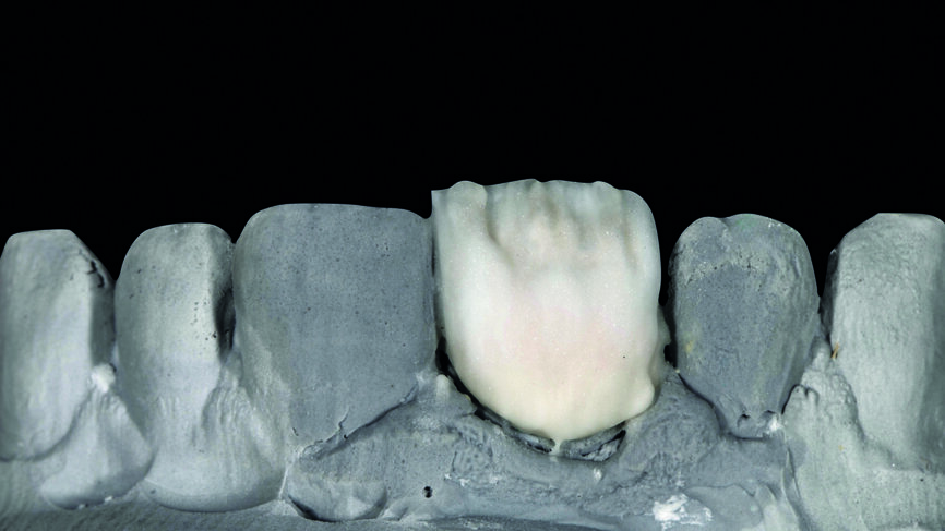Fig. 9 : Création des effets internes avec EOP – Opal booster, TM-02, EOP-2 et CT23.