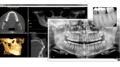 Danaher acquires PaloDEx