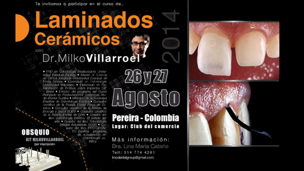 Curso sobre laminados cerámicos