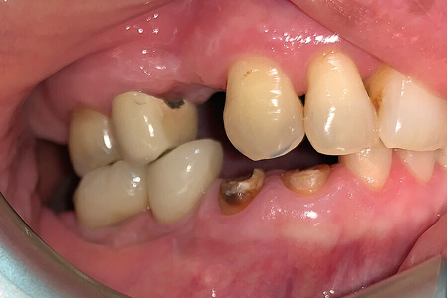 Fig. 1. Vista del caso preoperatorio