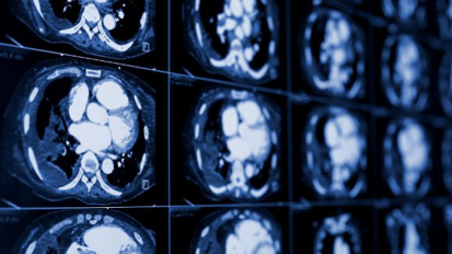 Компания 3DISC выпускает новое программное обеспечение для работы с изображениями