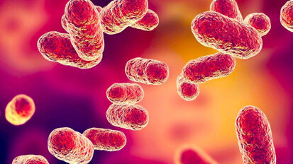 Alzheimer y enfermedad periodontal