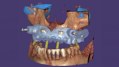 Il nuovo exoplan 3.0 Galway è ora disponibile