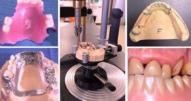 Edición Especial sobre Odontogeriatría