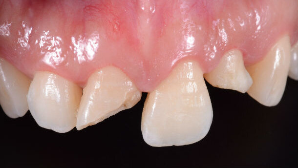 Snellire la lavorazione in laboratorio? Servono validi protocolli