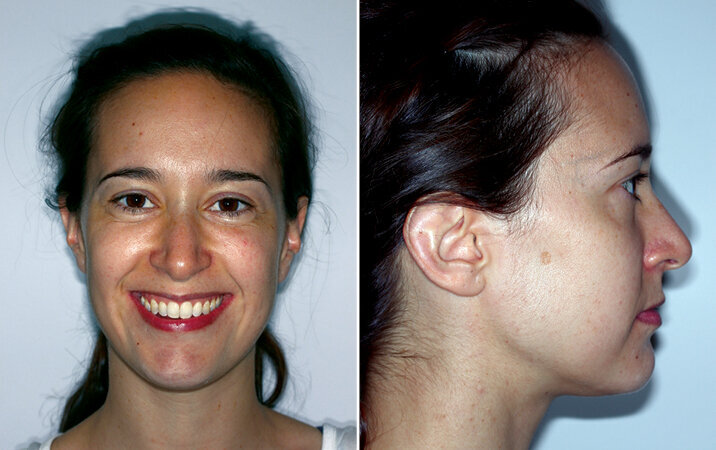 Konečná foto a RTG dokumentace