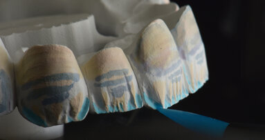 IDS 2023: Discover new opportunities with products from Kuraray Noritake Dental