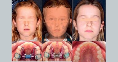 Nuevas Tecnologías y Técnicas en Ortodoncia y Ortopedia Dentofacial Digital