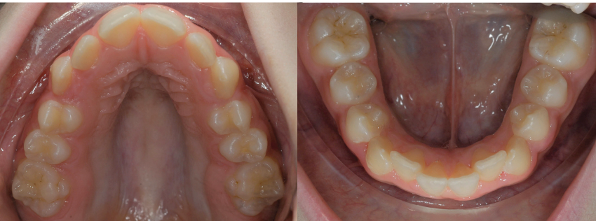 Fig. 1_Situazione intraorale a inizio terapia. 