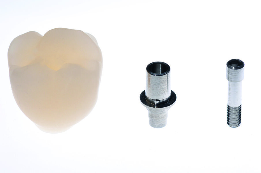 Fig. 11: The components of the superstructure, consisting of abutment crown, titanium base and screw.
