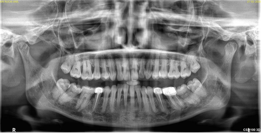 Fig. 1b:  10 year follow-up.